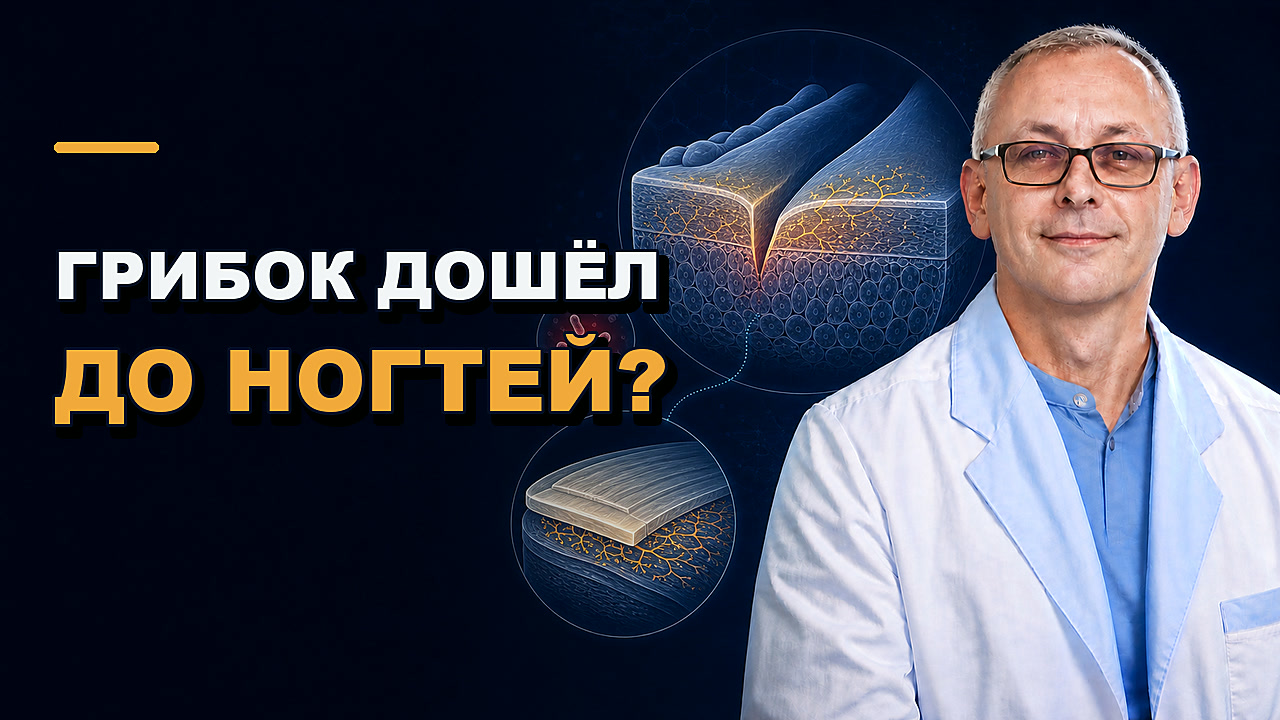 Обложка видео: Грибок стоп и ногтей: что будет без лечения